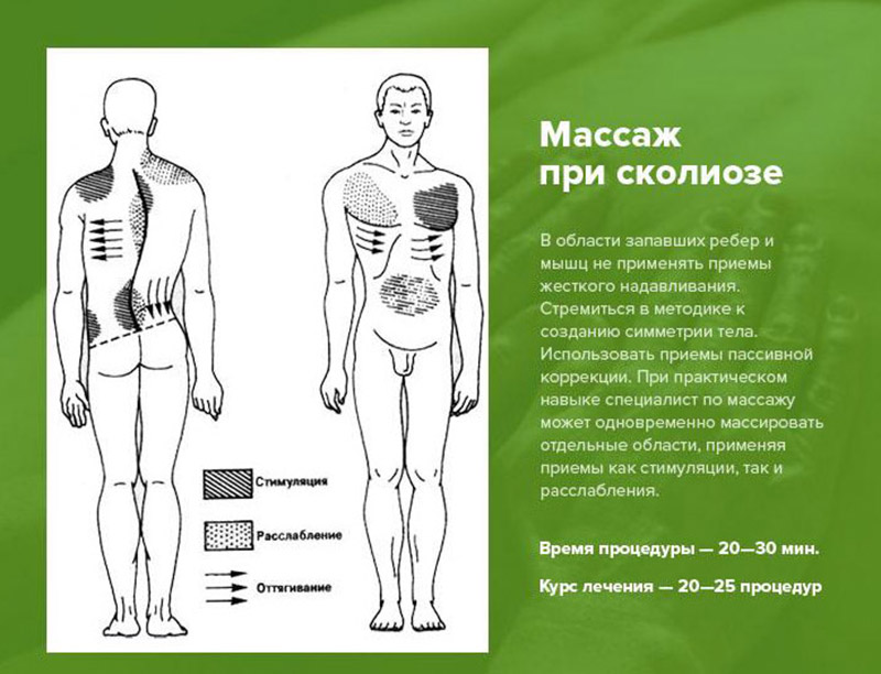 Армянская свадьба церковь Армянская свадьба церковь