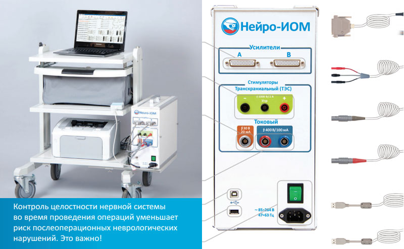 Нейрофизиологический мониторинг - аппарат Нейро-ИОМ