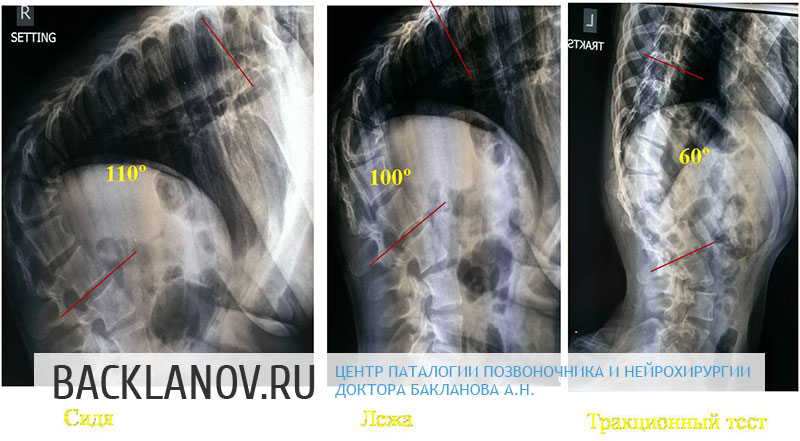 Патология позвоночника и нейрохирургии доктора бакланова а.н Патология позвоночника и нейрохирургии доктора бакланова а.н