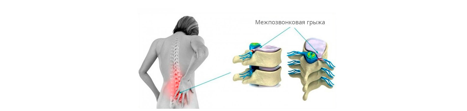 Коричневые месячные и болит спина Коричневые месячные и болит спина