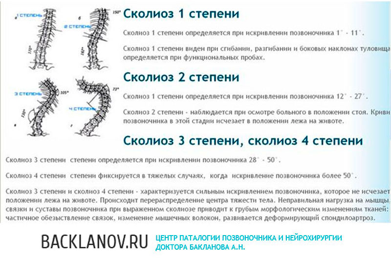 10 степень сколиоза. S образное искривление позвоночника 3 степени. S образный грудопоясничный сколиоз 1 степени. Е образный грудопоясничный сколиоз 2 степени. Z образный сколиоз 2 степени.